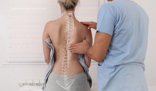 Escoliose, cifose e lordose - conheça os principais desvios de coluna