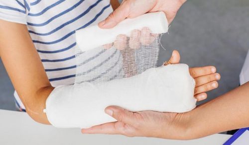 O uso do gesso em ortopedia / Tirar o gesso antes da hora pode ser prejudicial?