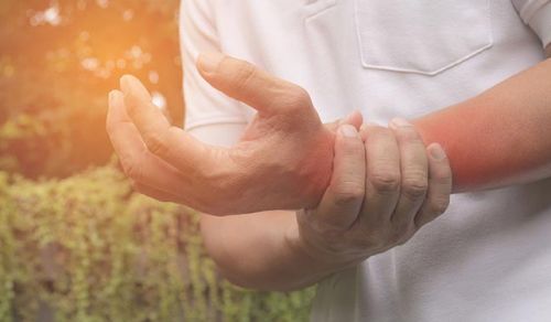 Entorse de punho (punho torcido)