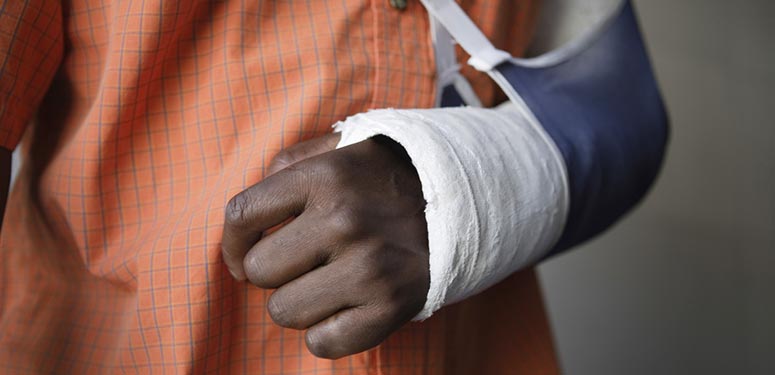 fraturas na mao e membro superior